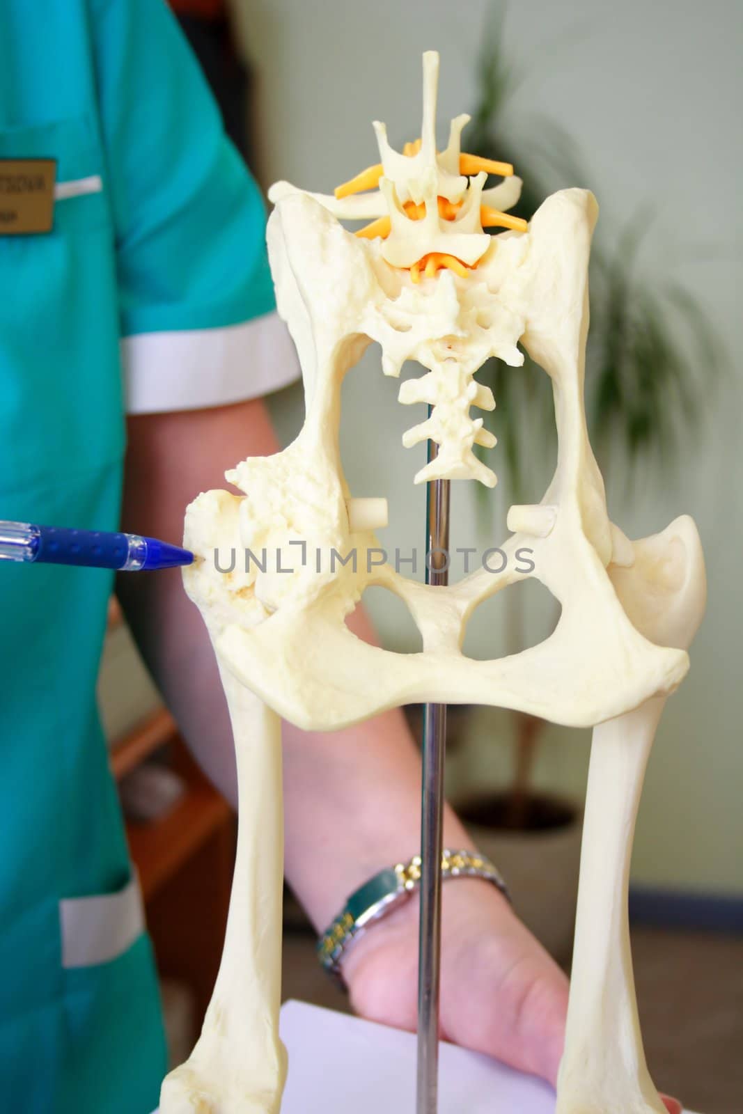 Hip dysplasia model of the dog by vetdoctor