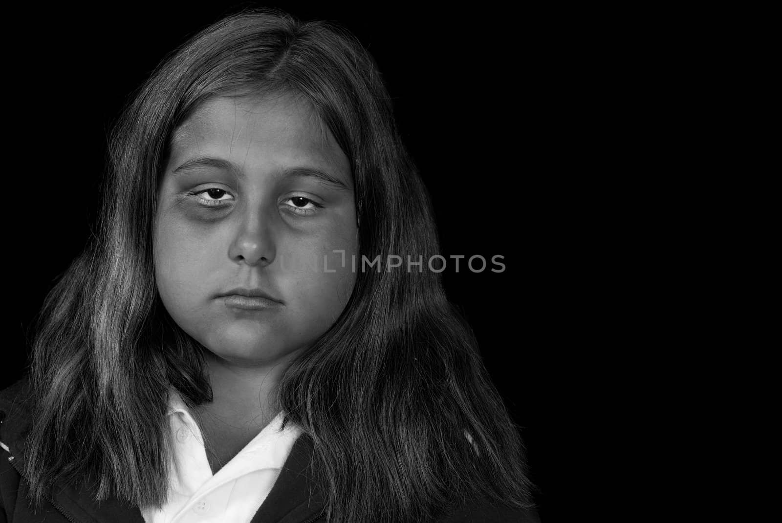 Concept image of child abuse or depression, featuring a young girl with a black eye, isolated against a black background