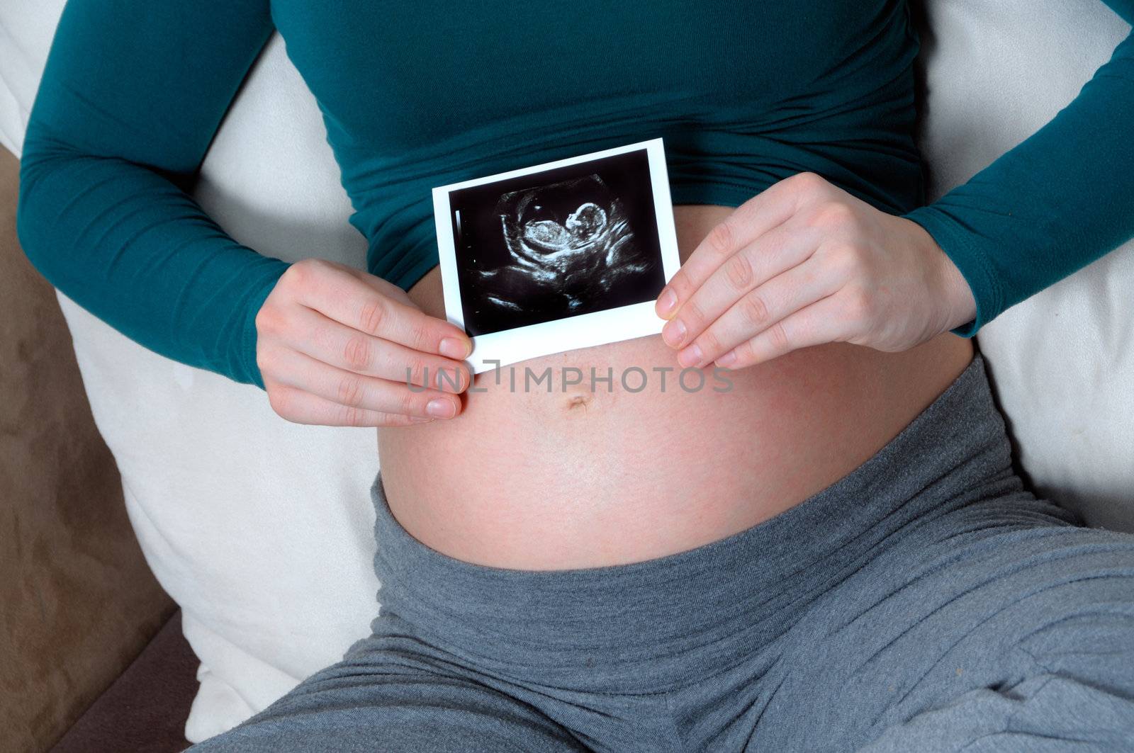 Pregnant woman by fahrner