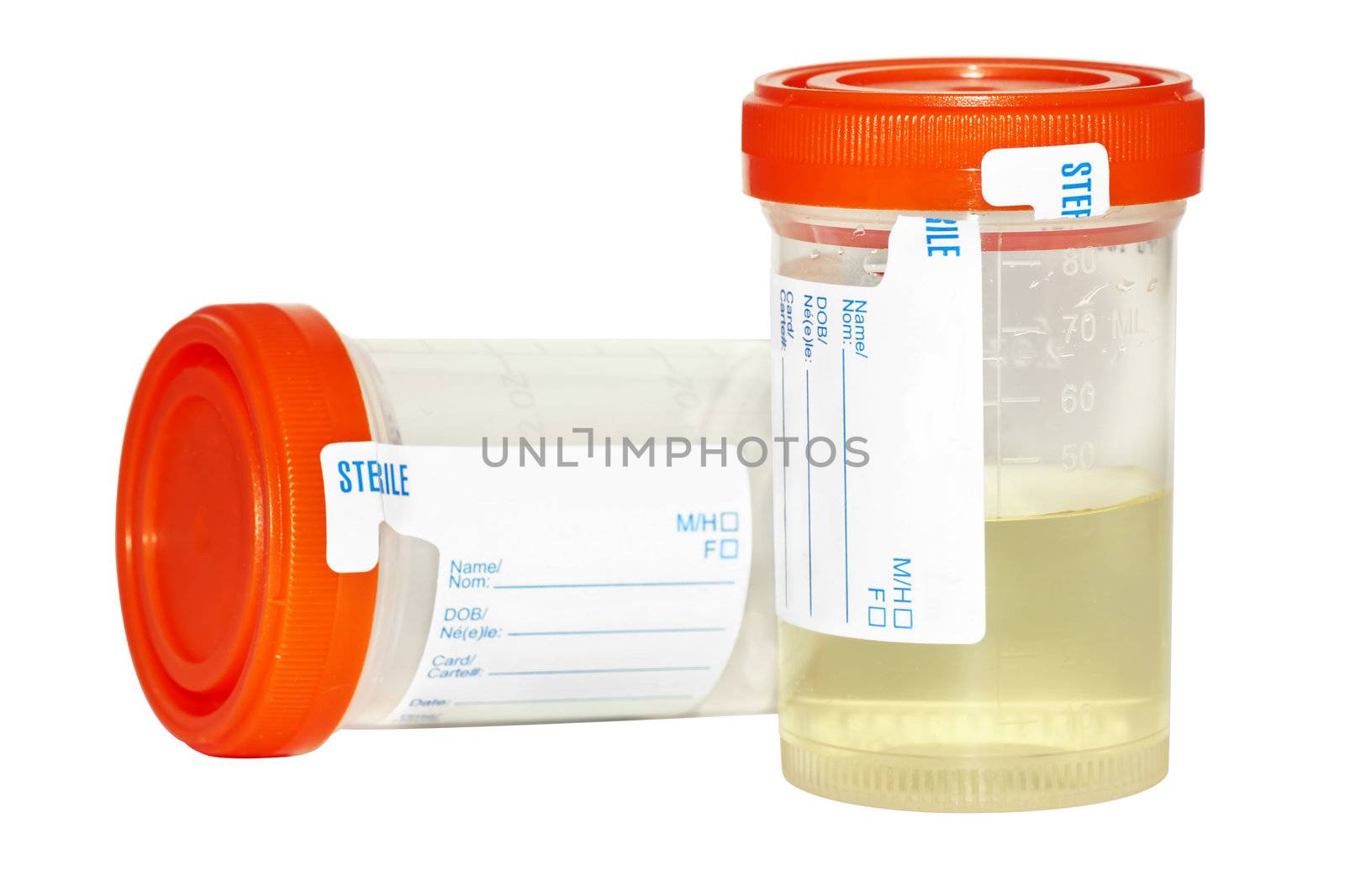 Urine sample collection bottles, one empty and sterile and the other filled with pee to be analyzed isolated on white background.