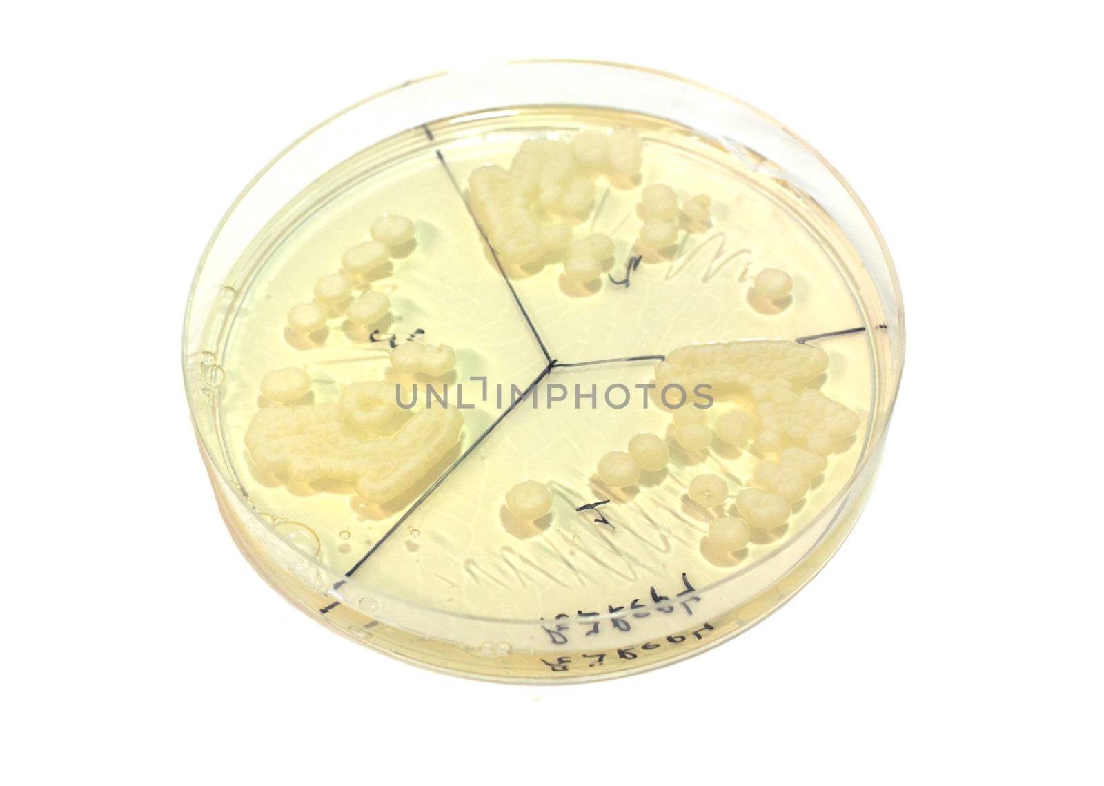 microbiological plate whith white colonies of fungi isolated on white