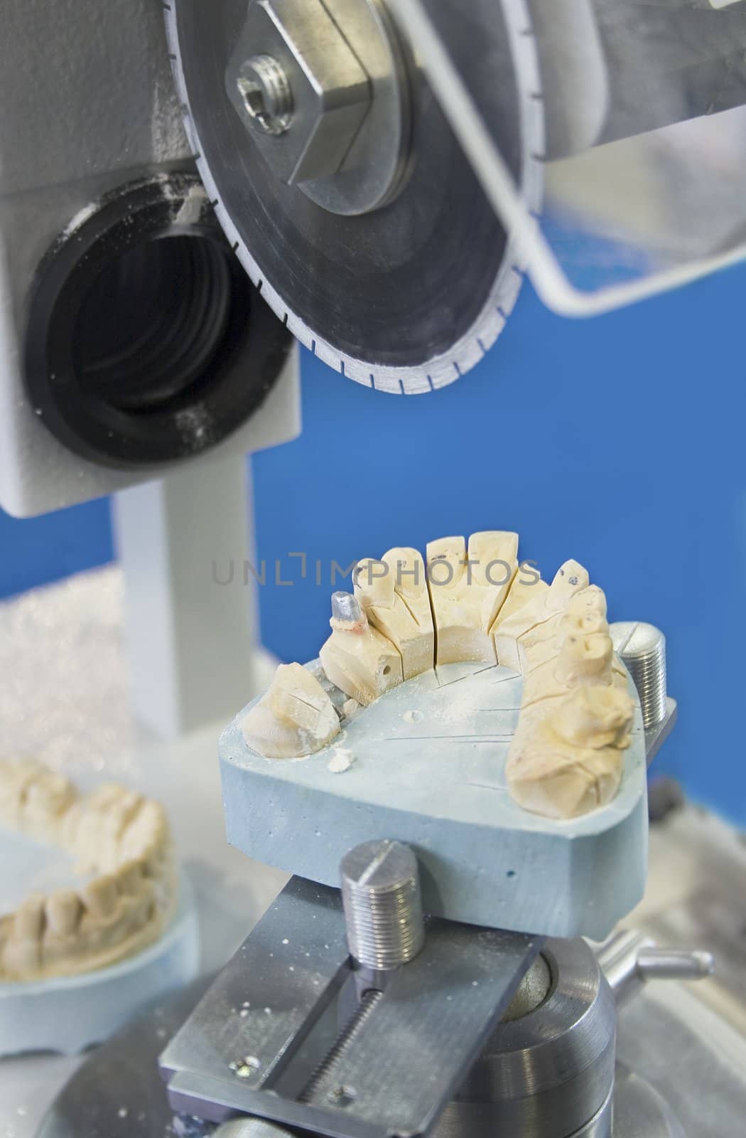 Dental equipment for cut of ceramic-meta teeth.