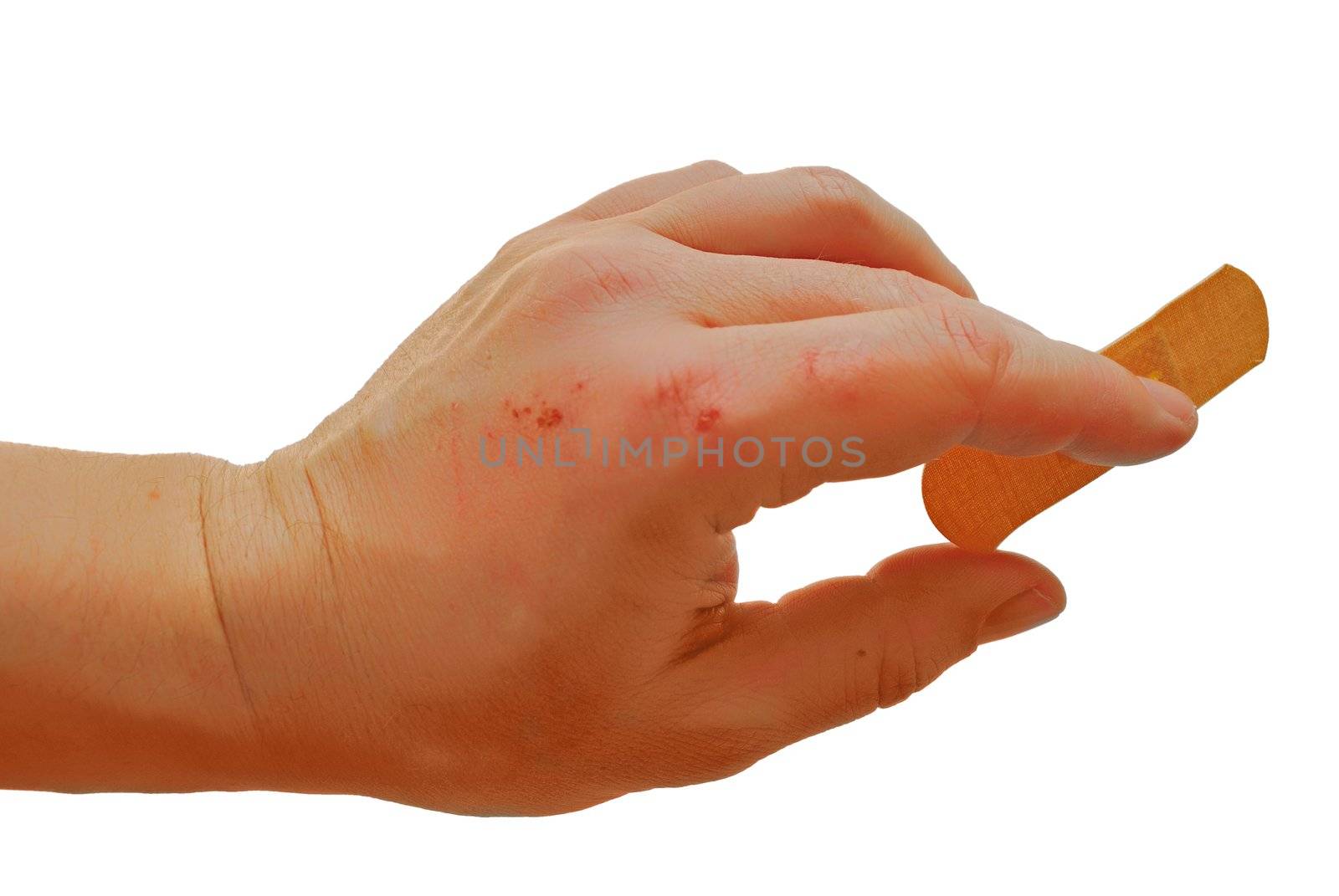 abrasional male hand with court plaster (soft bant)