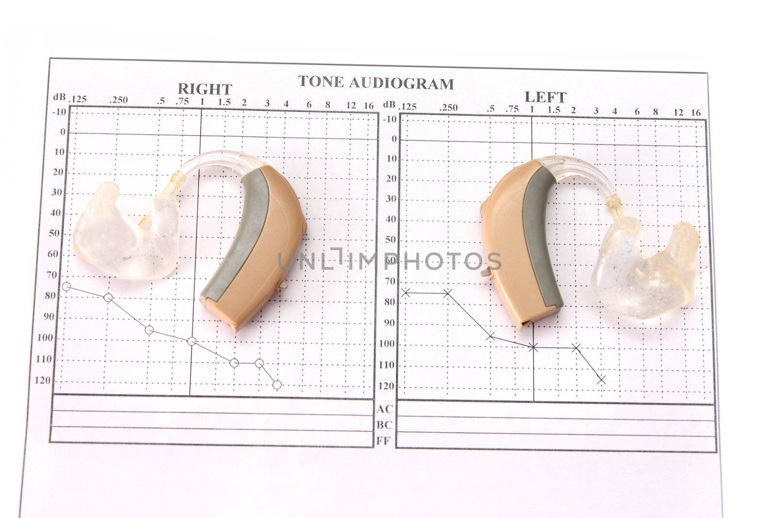 Hearing medical chart showing and hearing aid