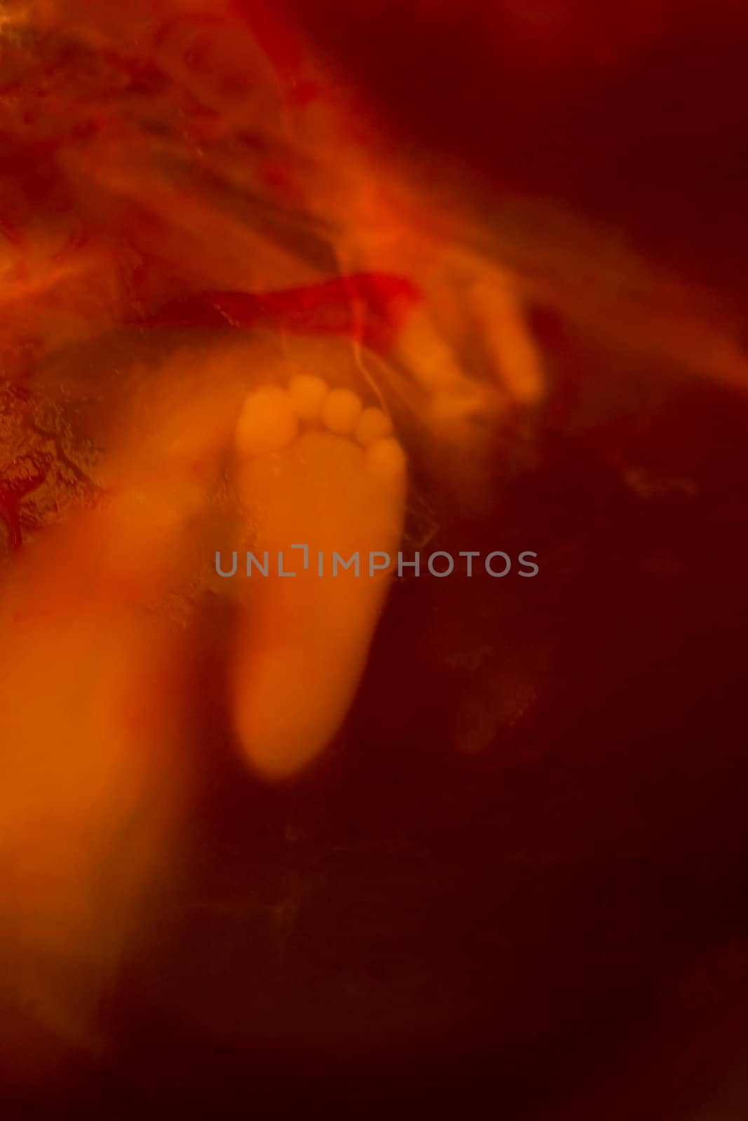 A shot of our premature stillborn son just after giving birth to him at home. I understand this image may not be agreeable to some but as an artist, photographer and father I find it captivating.