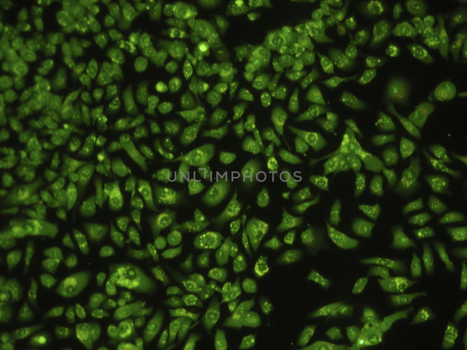 Alive human lung cancer cells under microscope