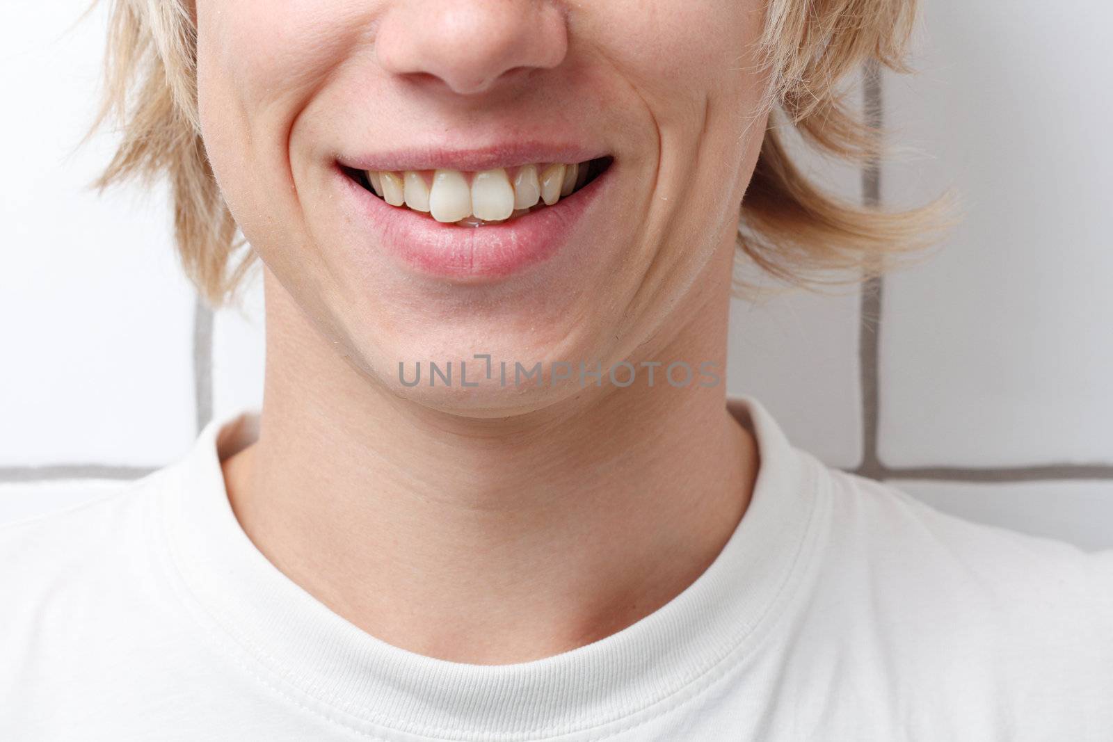 A man smiling showing his smile