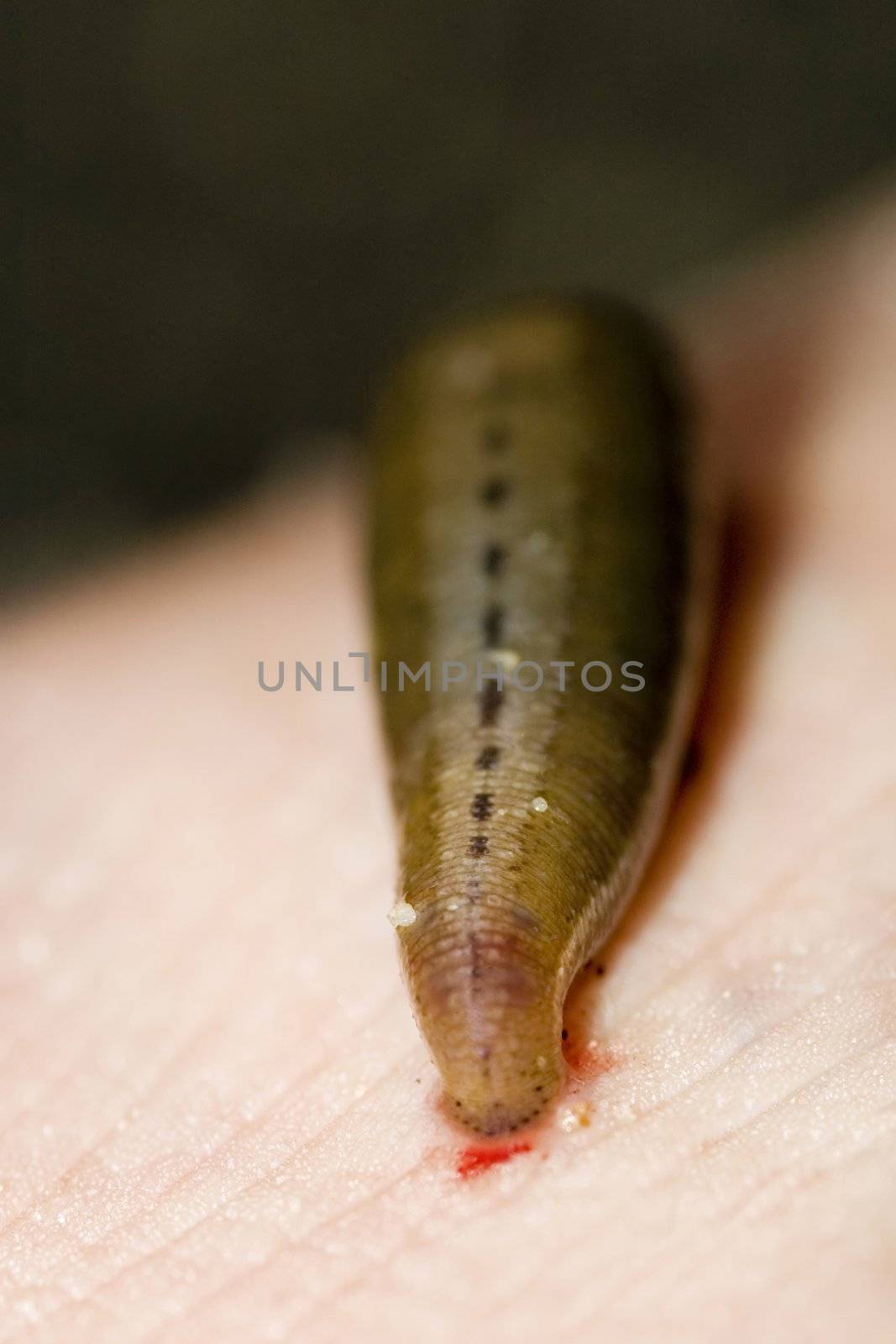 Leech sucking blood from a leg at tropical rainforest, Malaysia.