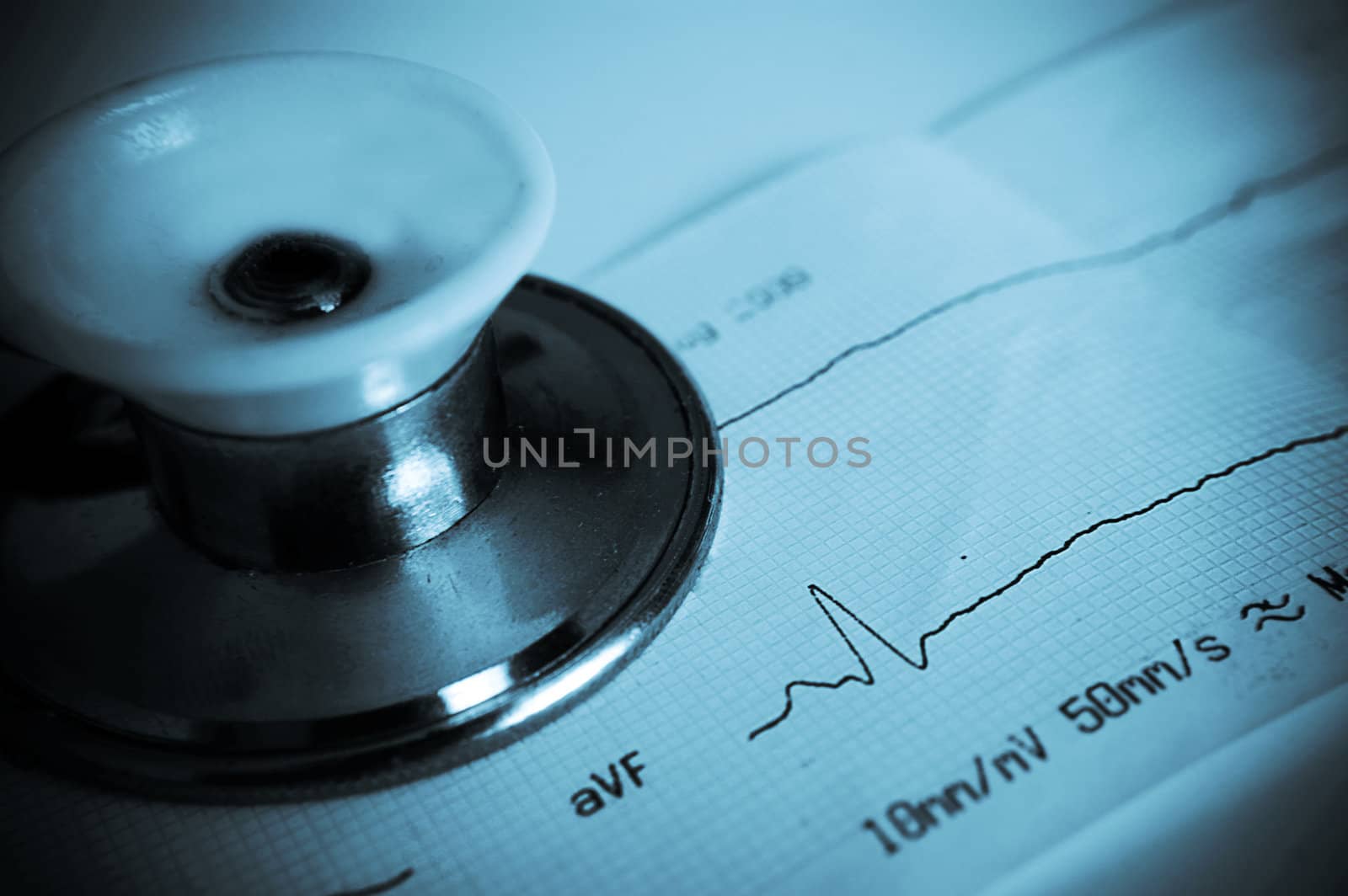 Close-up of a ECG strips with stethoscope, blue toned
