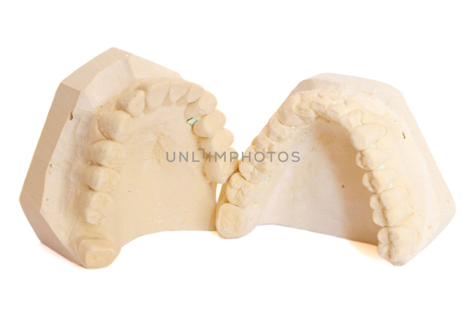 dental impression isolated against white background