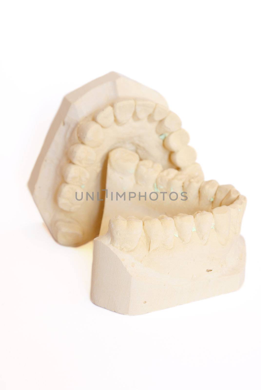 dental impression isolated against white background
