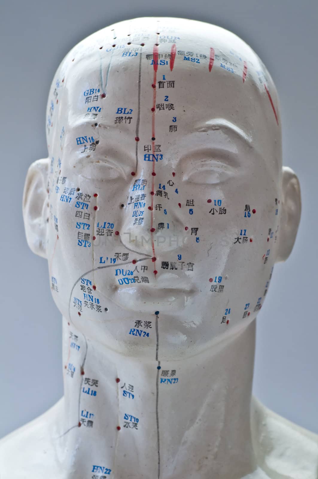 Acupuncture head model