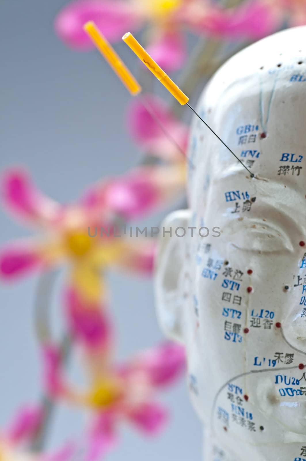 Acupuncture head model