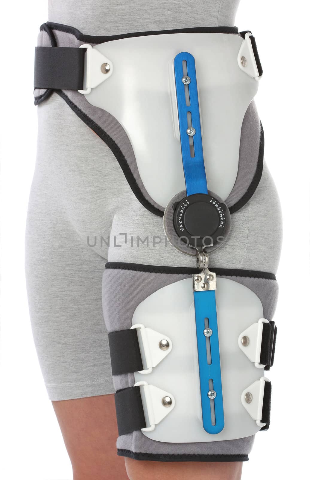 Woman with a hip splint, over white