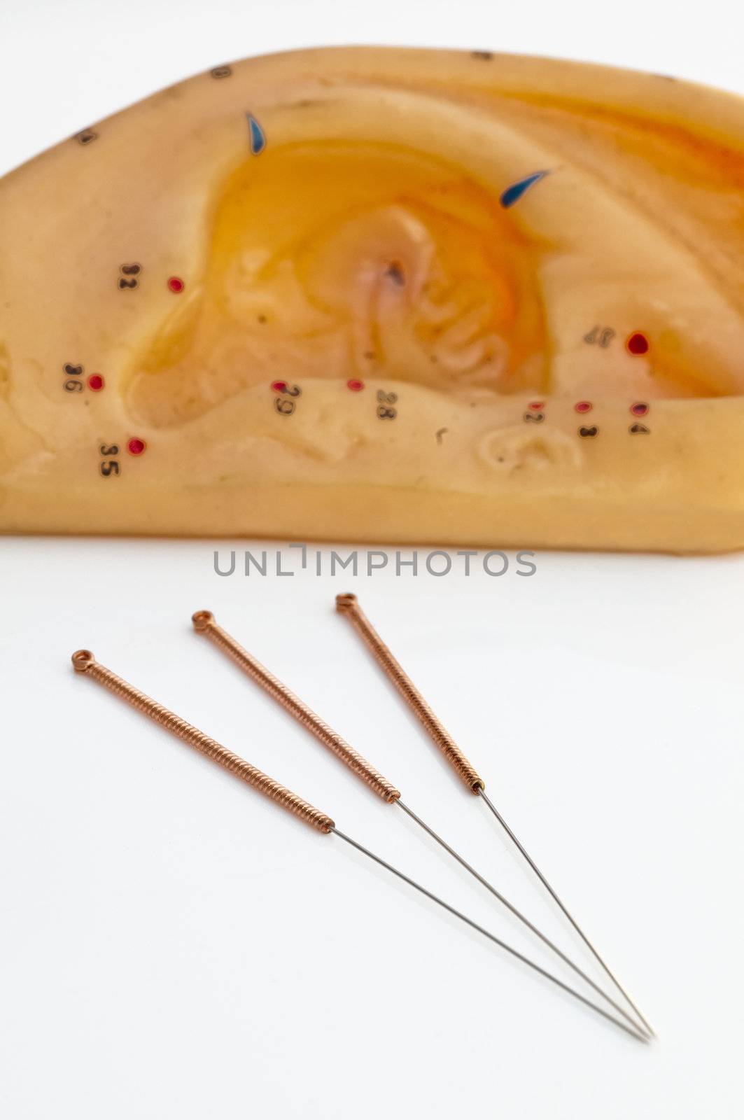 acupuncture needles for ear