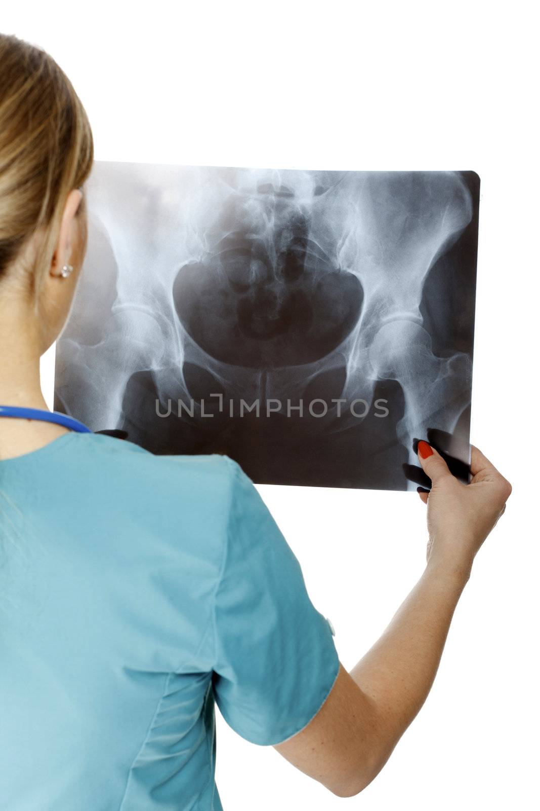 Female doctor examining an x-ray image. Focus is on the x-ray image.