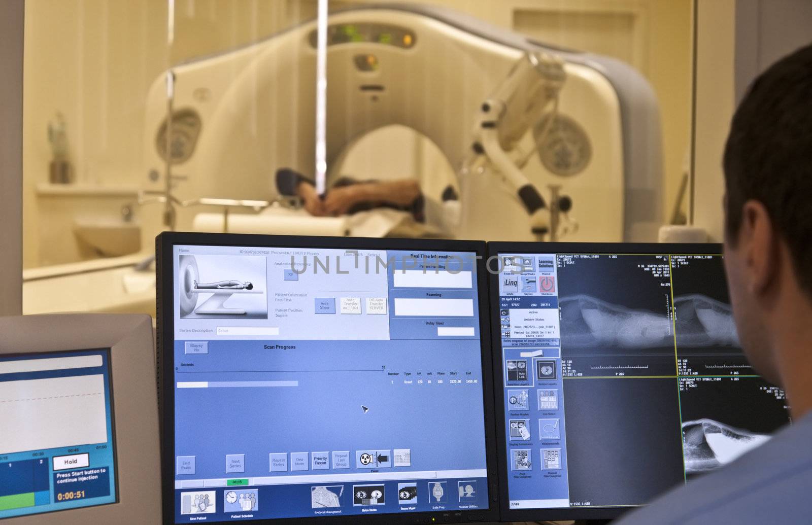 Magnetic resonance imaging machine control room with screens showing results