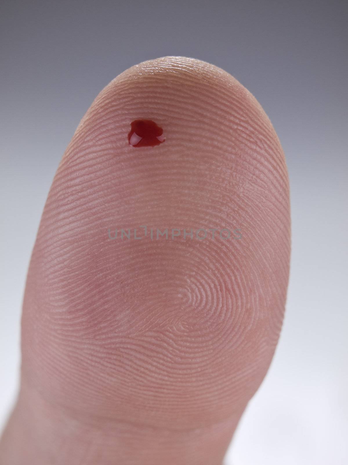 Macro view of a drop of real blood on a human thumb.