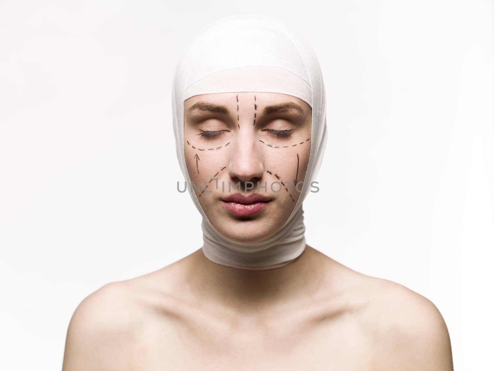 Woman prepared for a plastic surgery by gemenacom