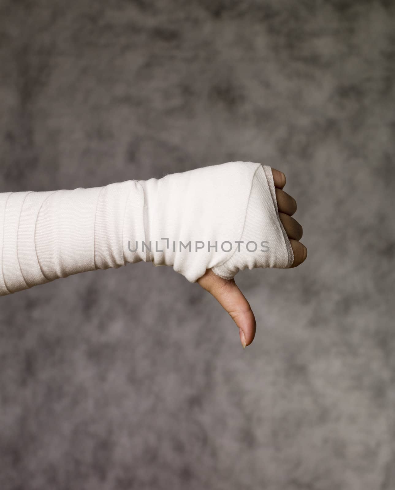 Thumbs down from injured hand