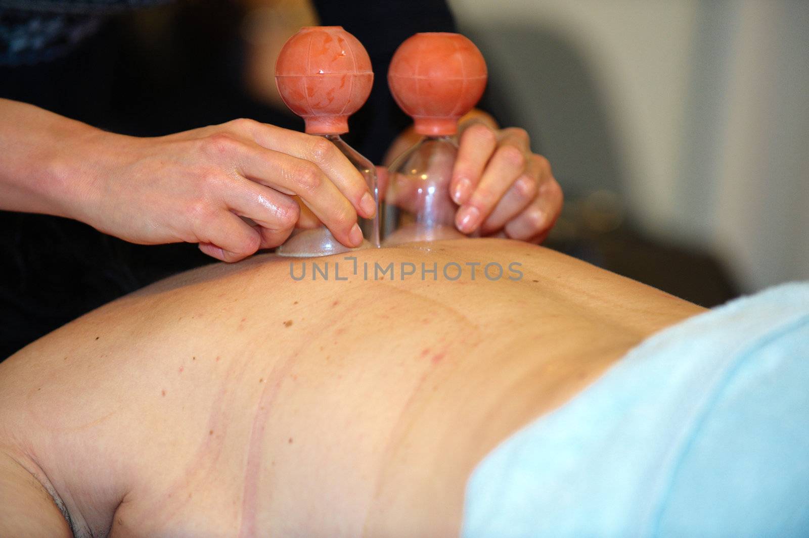 Spa Cupping Gua Sha to improve blood flow and relaxation