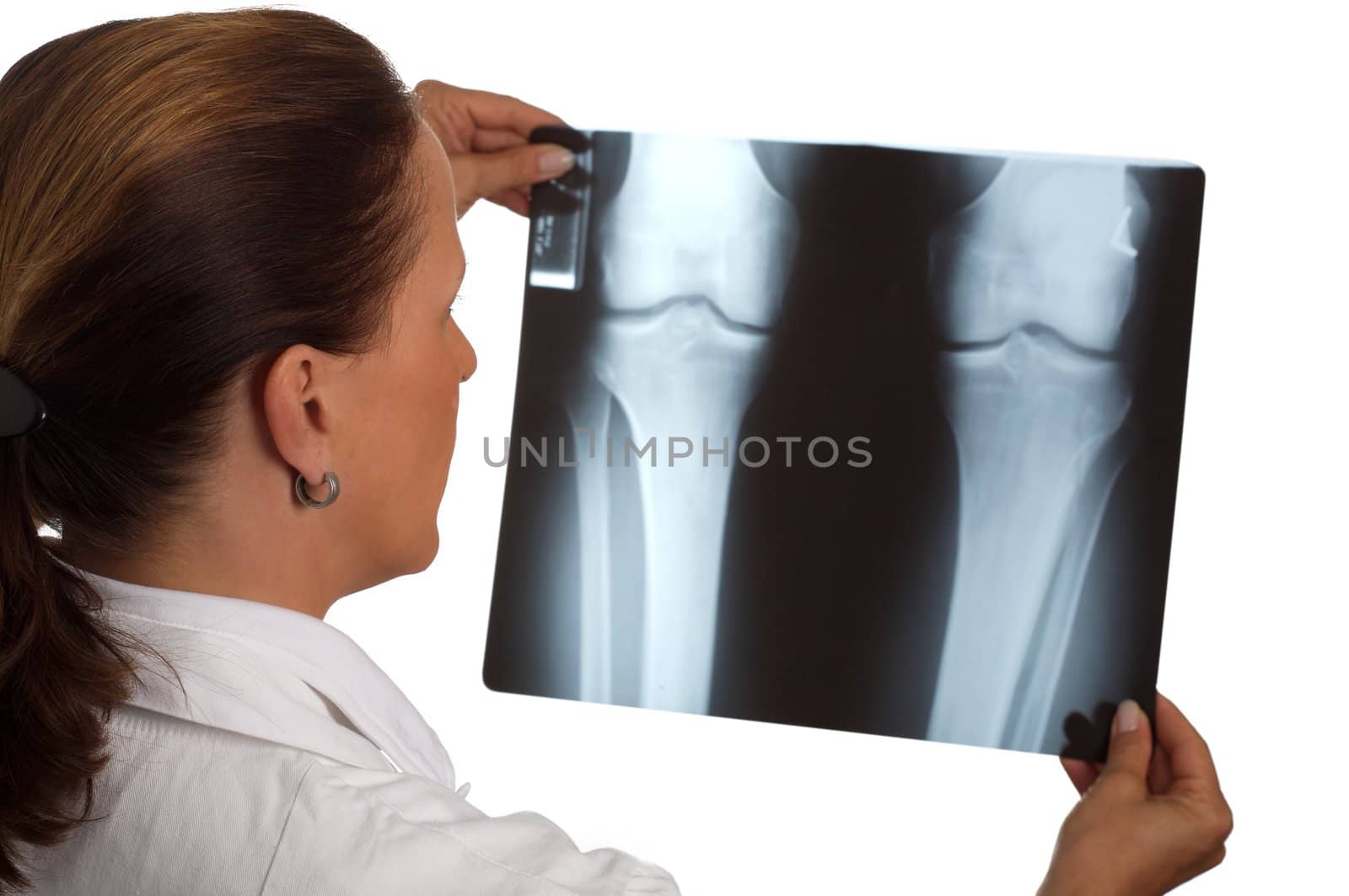 female doctor looking at a xray with white background