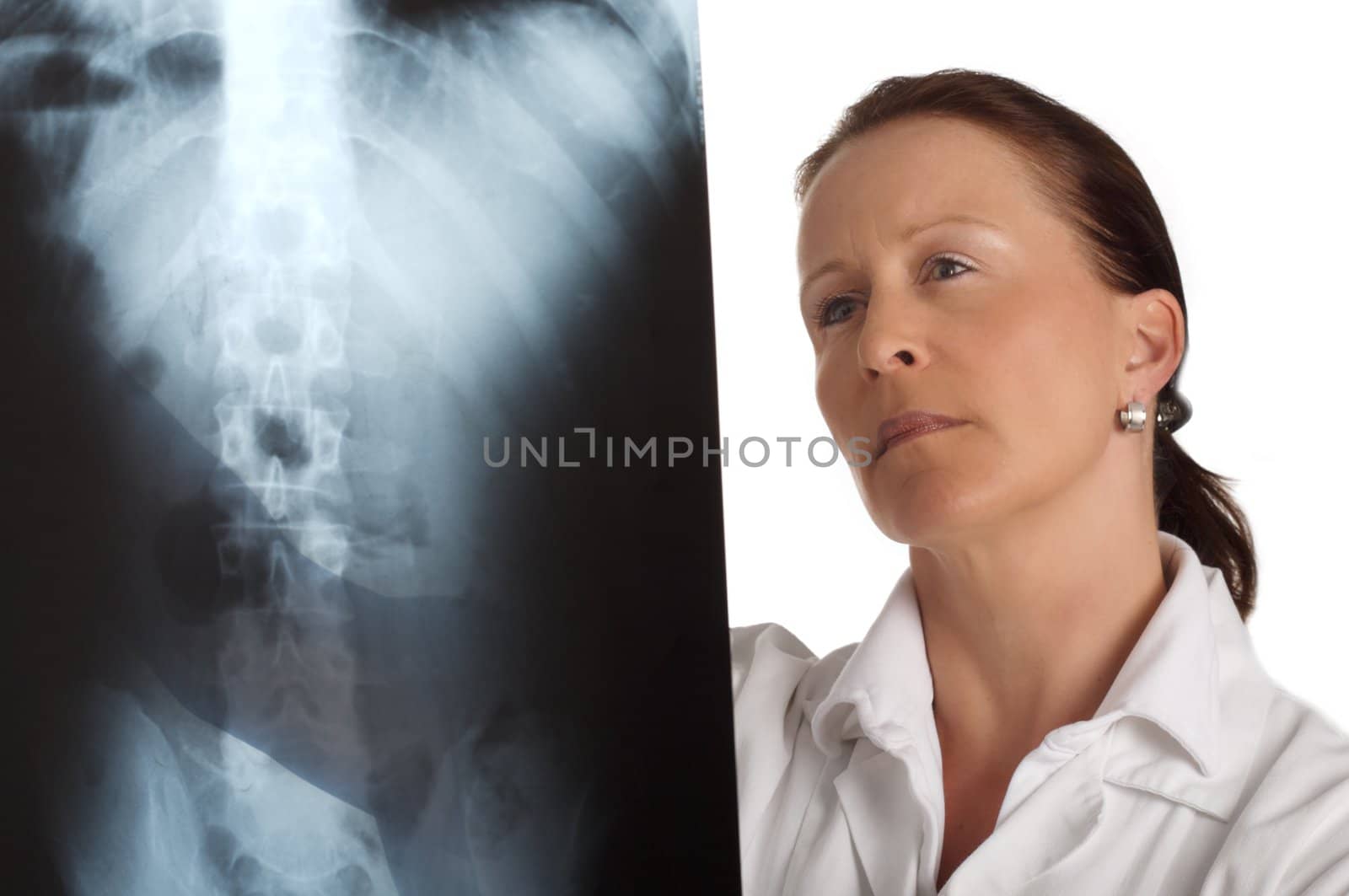 female doctor looking at a xray with white background