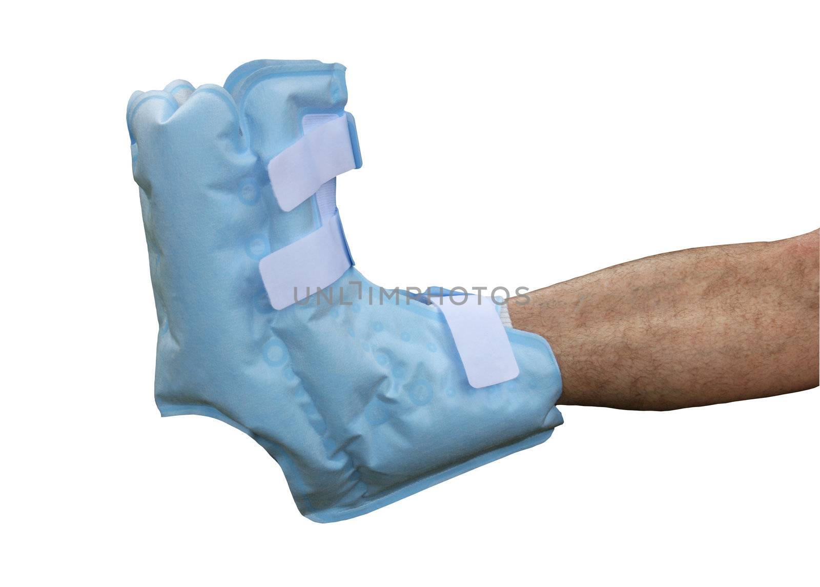 soft boot cast on right foot isolated with clipping path at this size