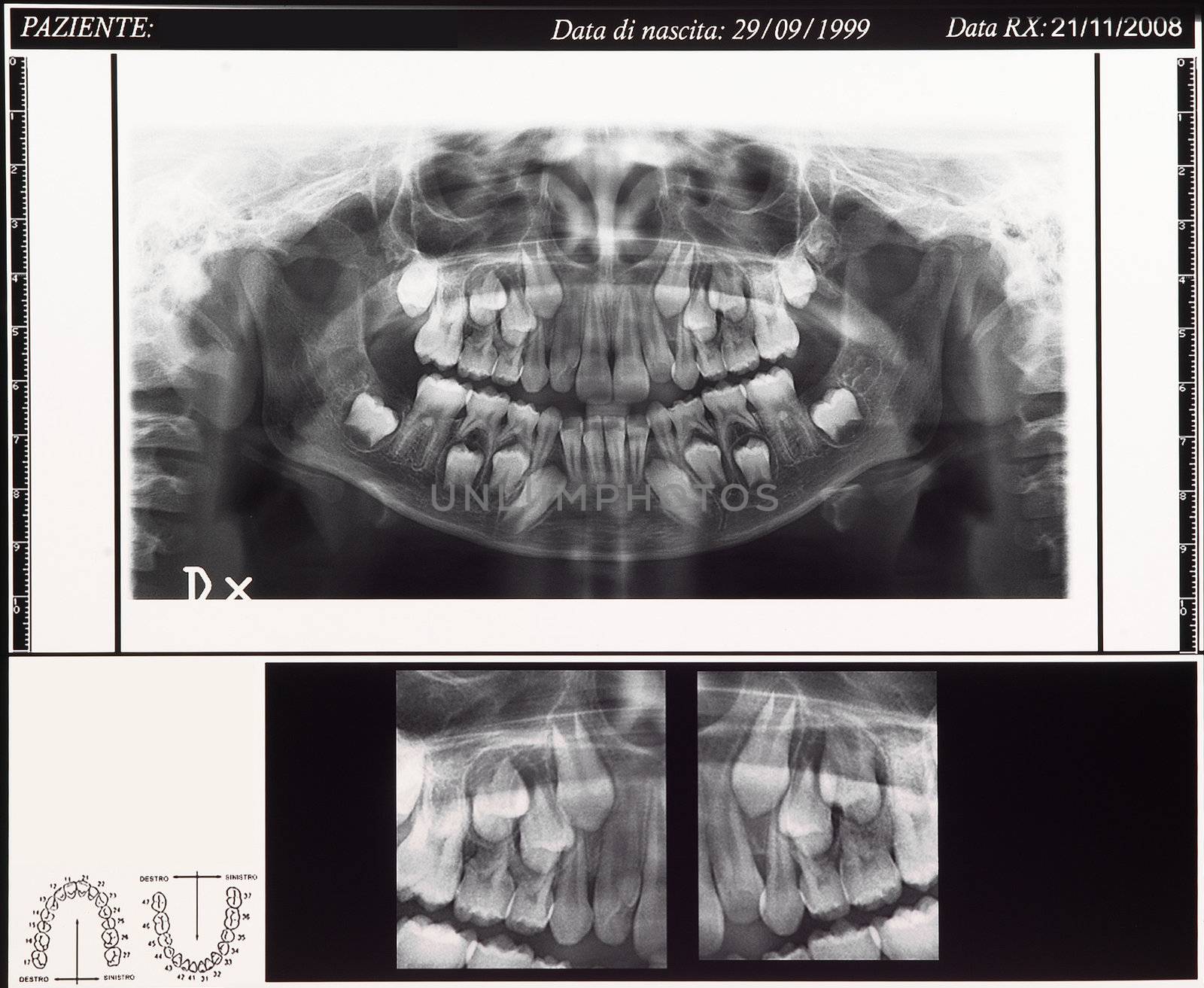 children 9 years dental scan by bravajulia