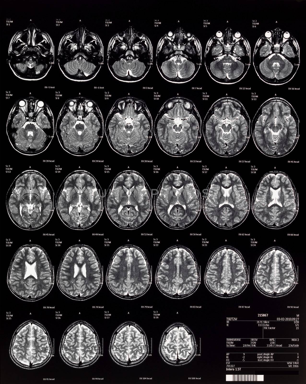 Brain MRI children 10 years by bravajulia