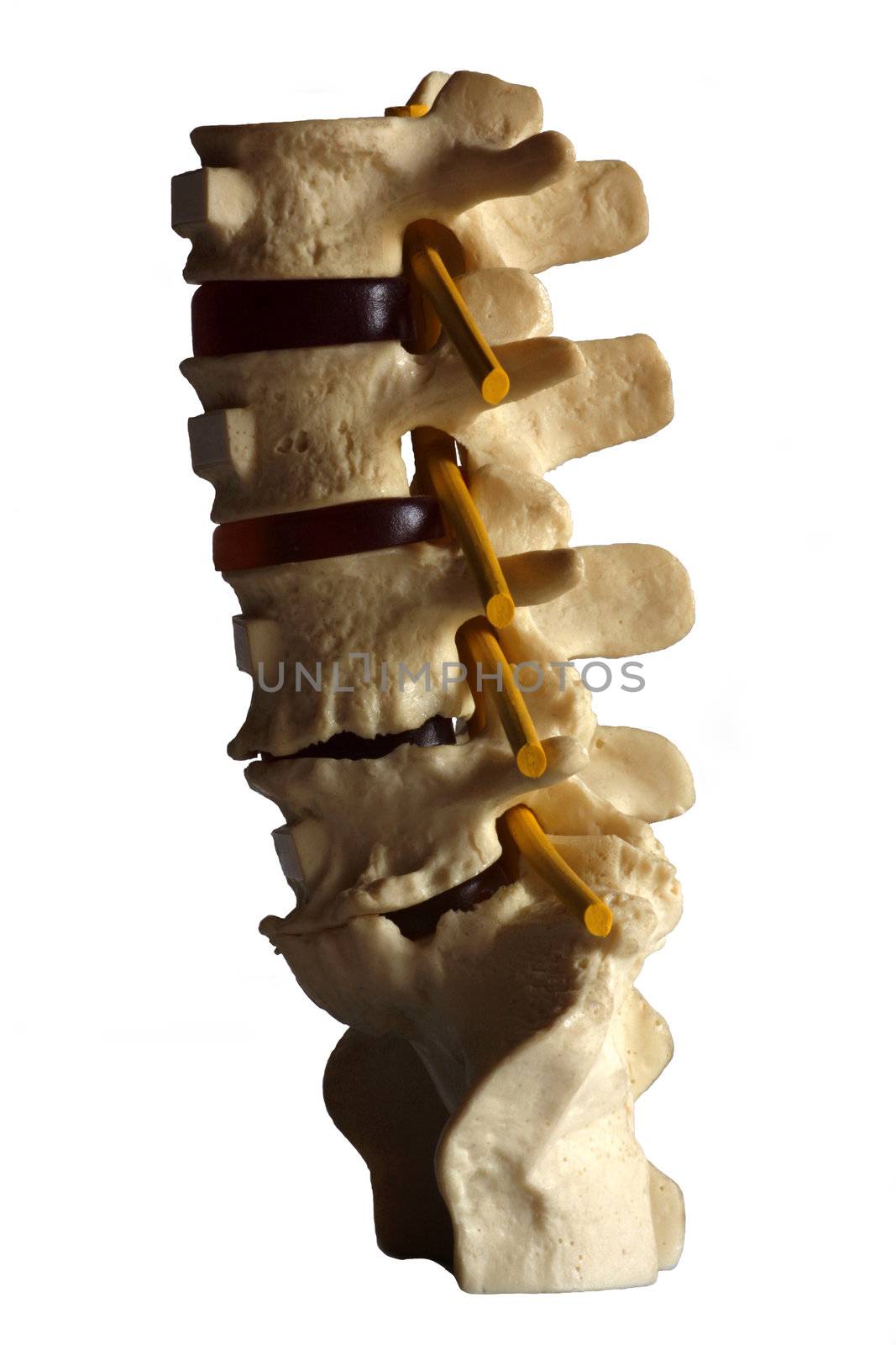 Spine by Imagecom