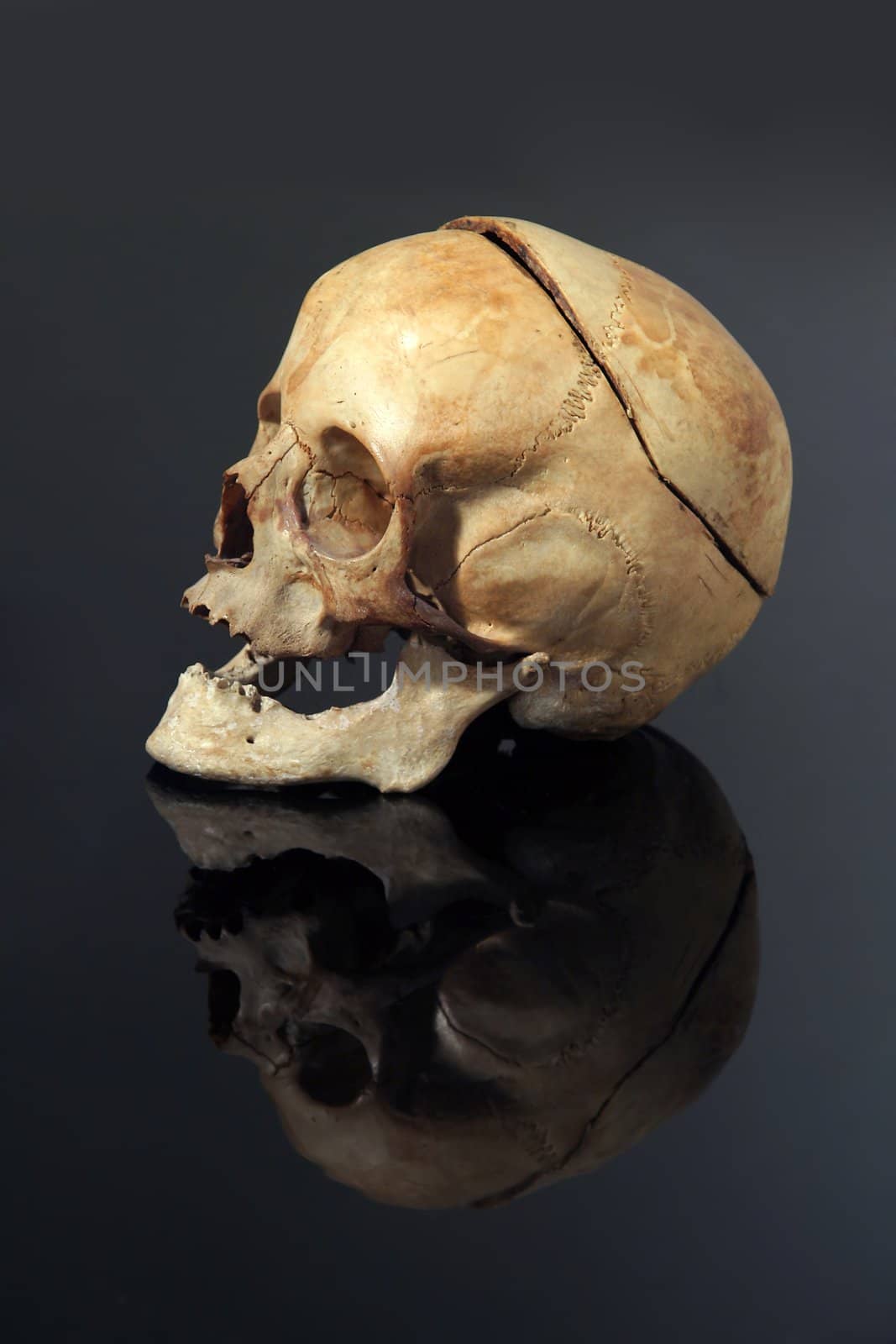 old woman skull on black reflective background, back of the head is sawed off 