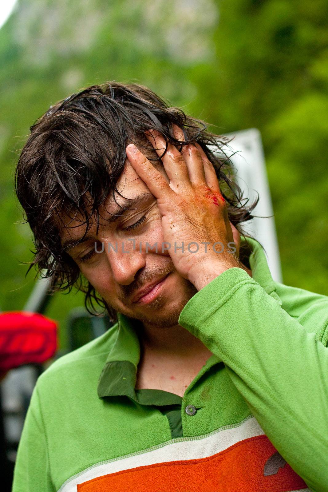 Portrait of kayaker bruise the hands, Norway, summer 2010