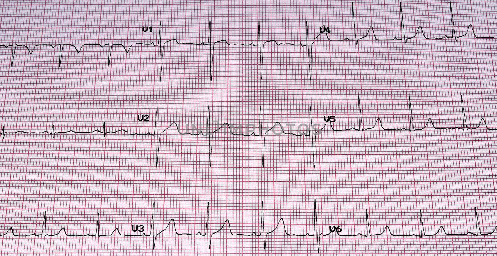 Heart analysis, ECG graph.