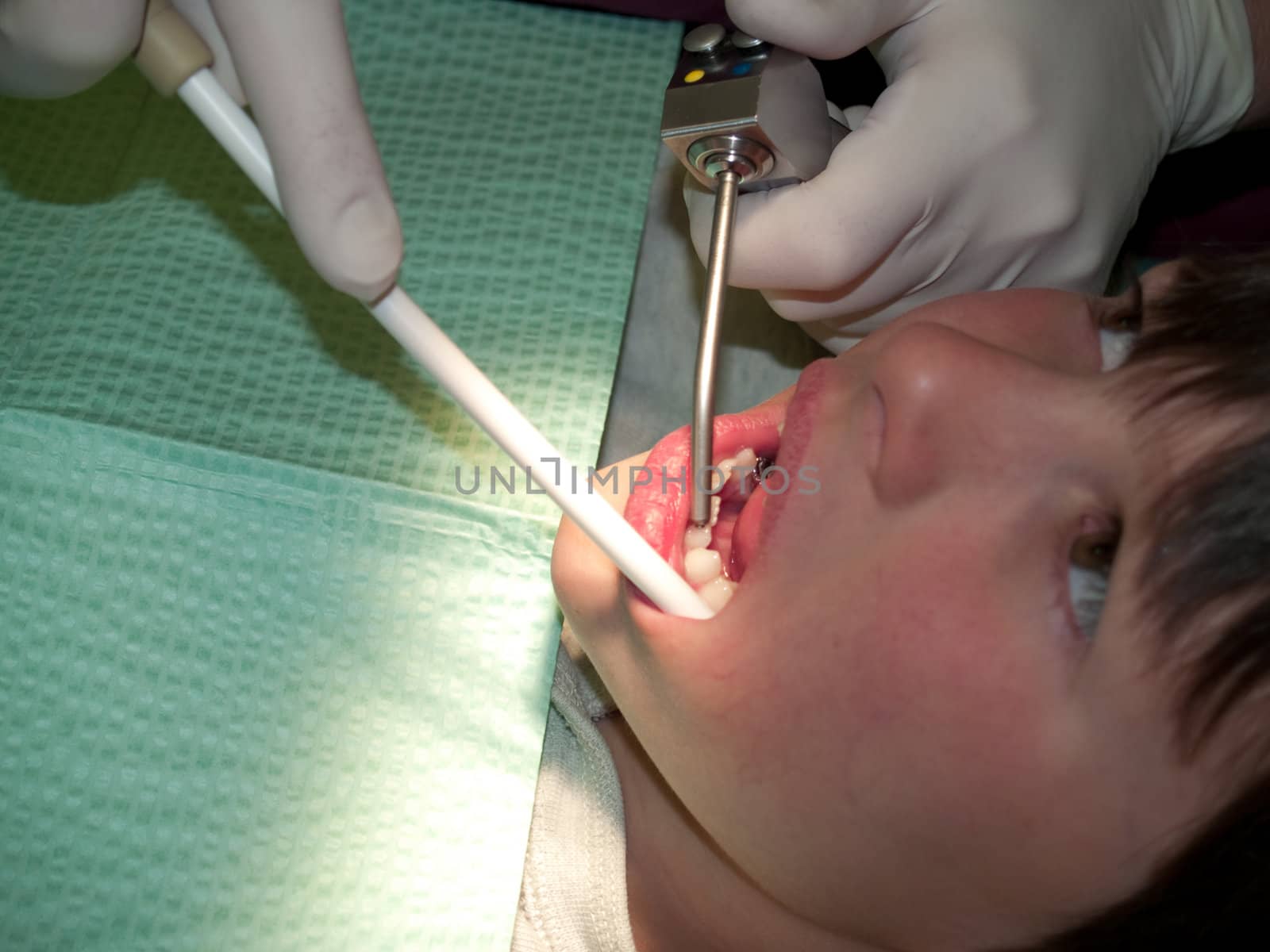 Hygienist working on a young boys mouth.