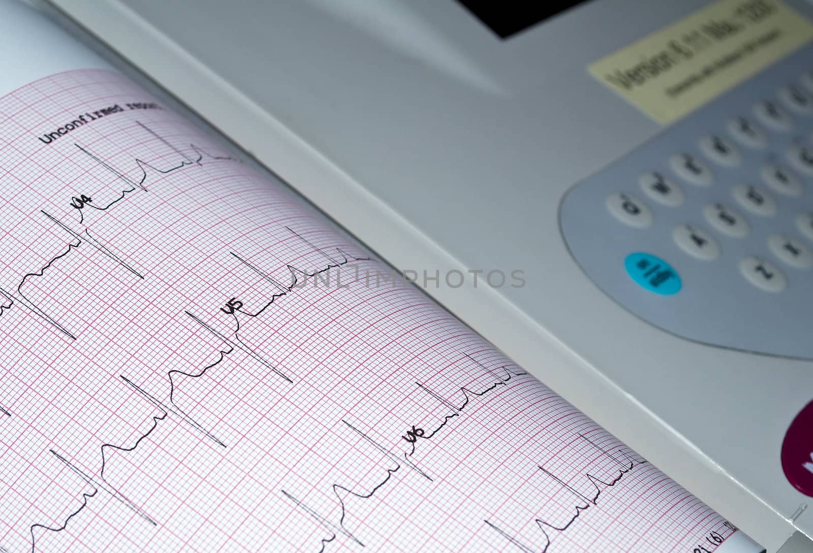 Electrocardiogram. by FER737NG