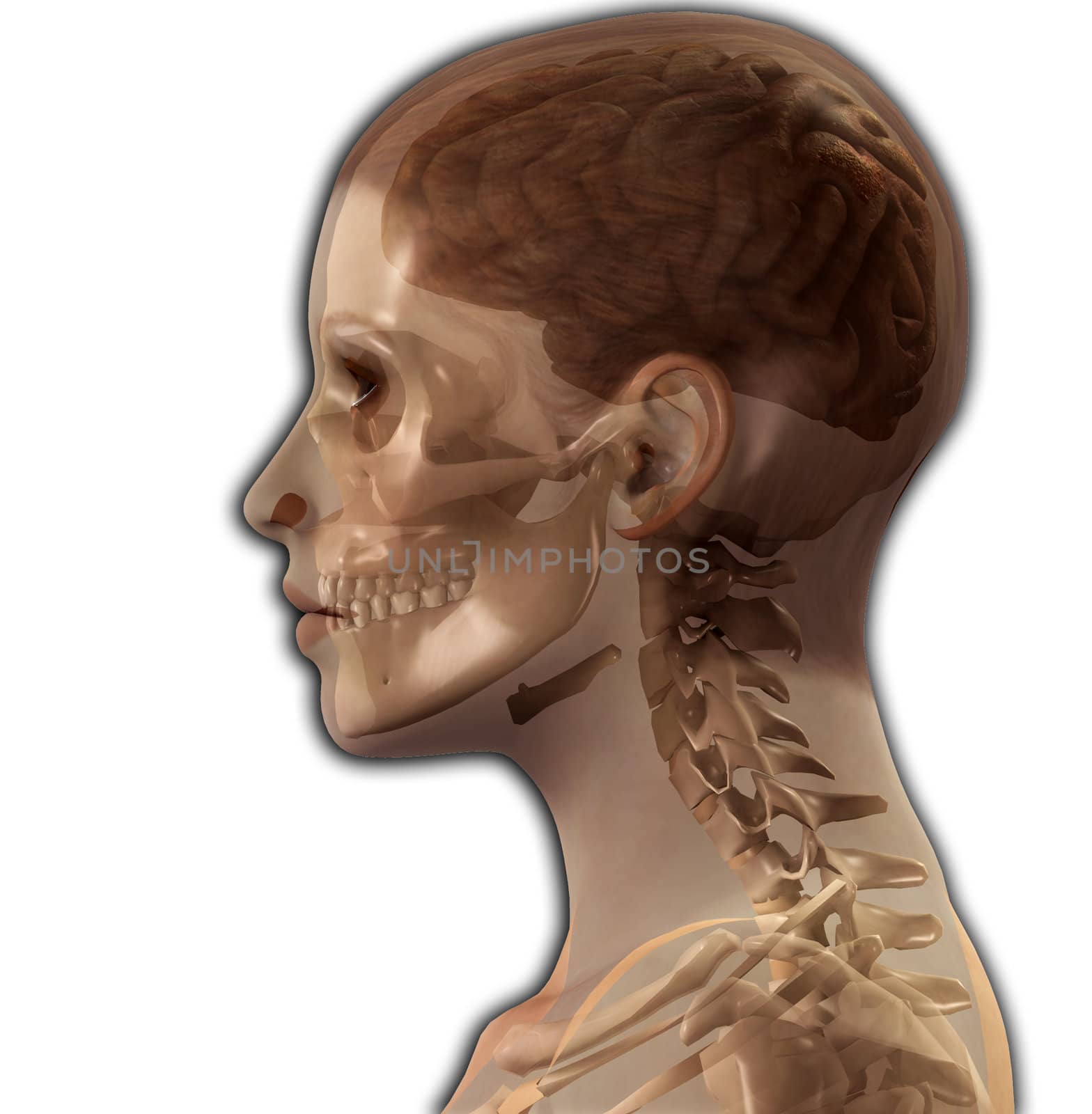 X Ray image of the inside of a womens head.