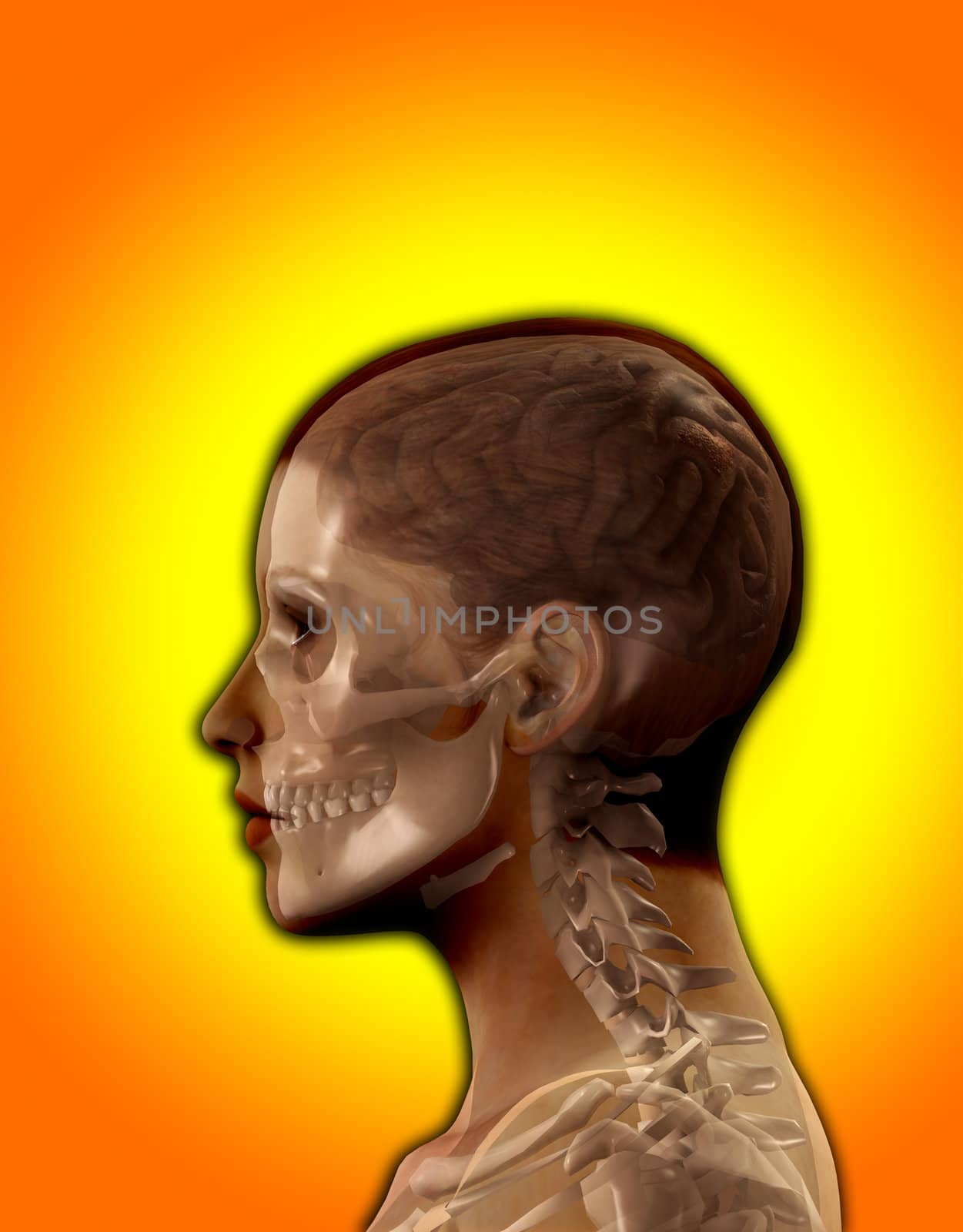 X Ray image of the inside of a womens head.