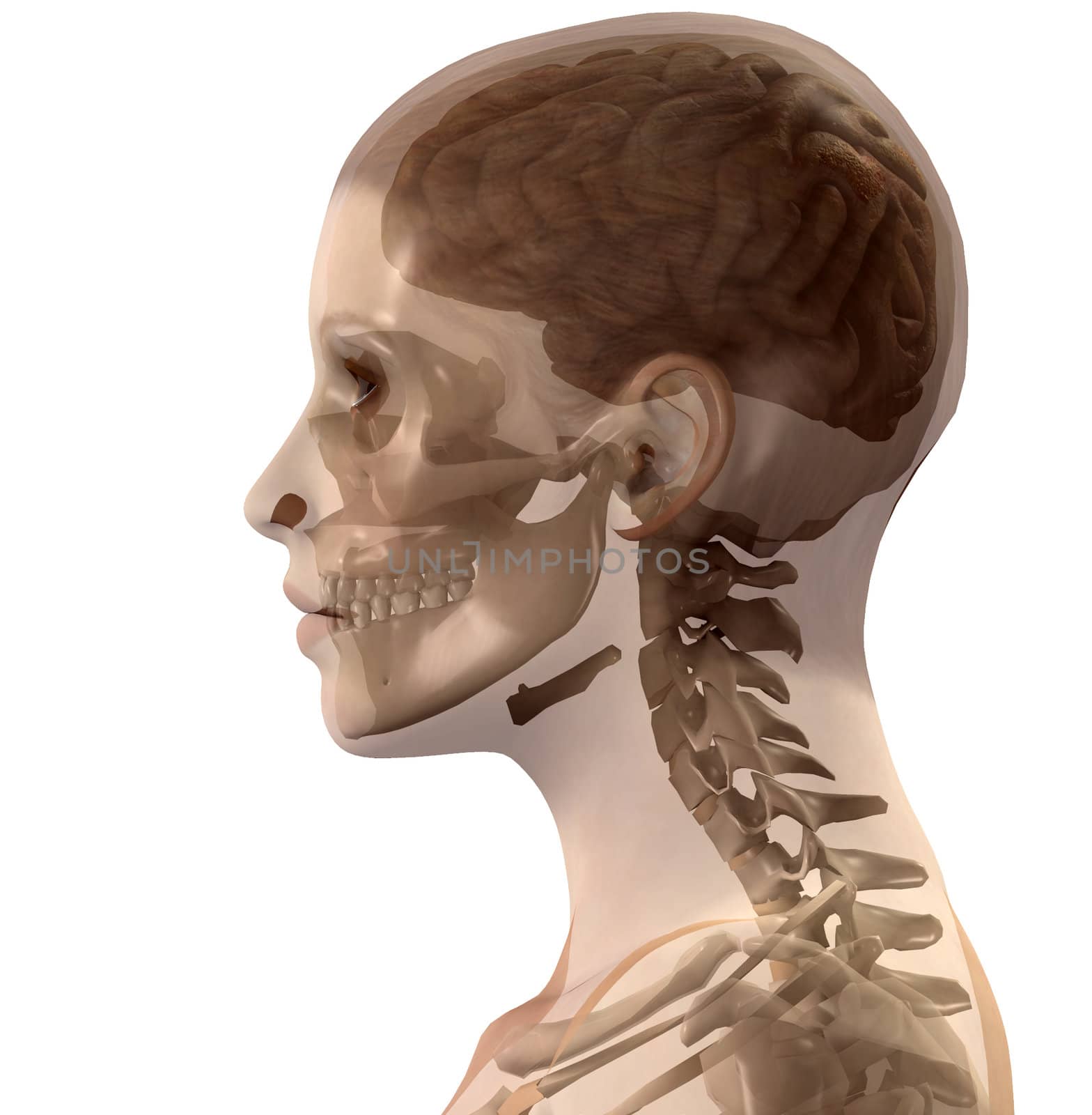 X Ray image of the inside of a womens head.