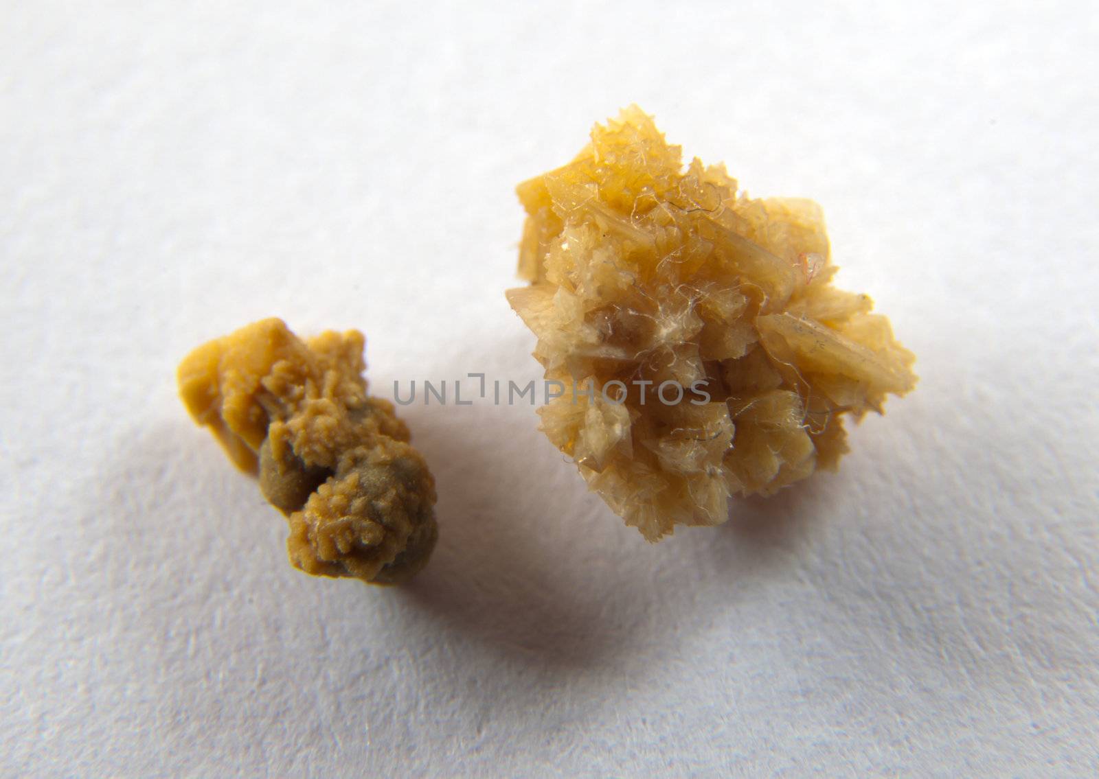 Couple of kidney stones on macro shot