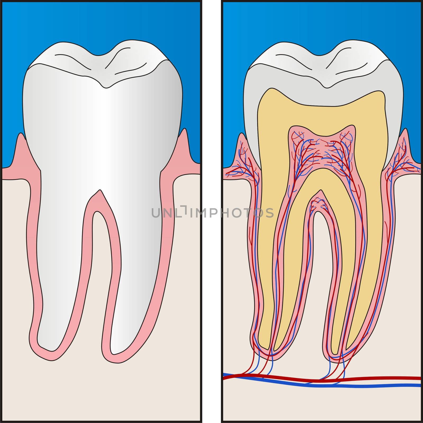 Healthy tooth and section of healthy tooth by vermicule