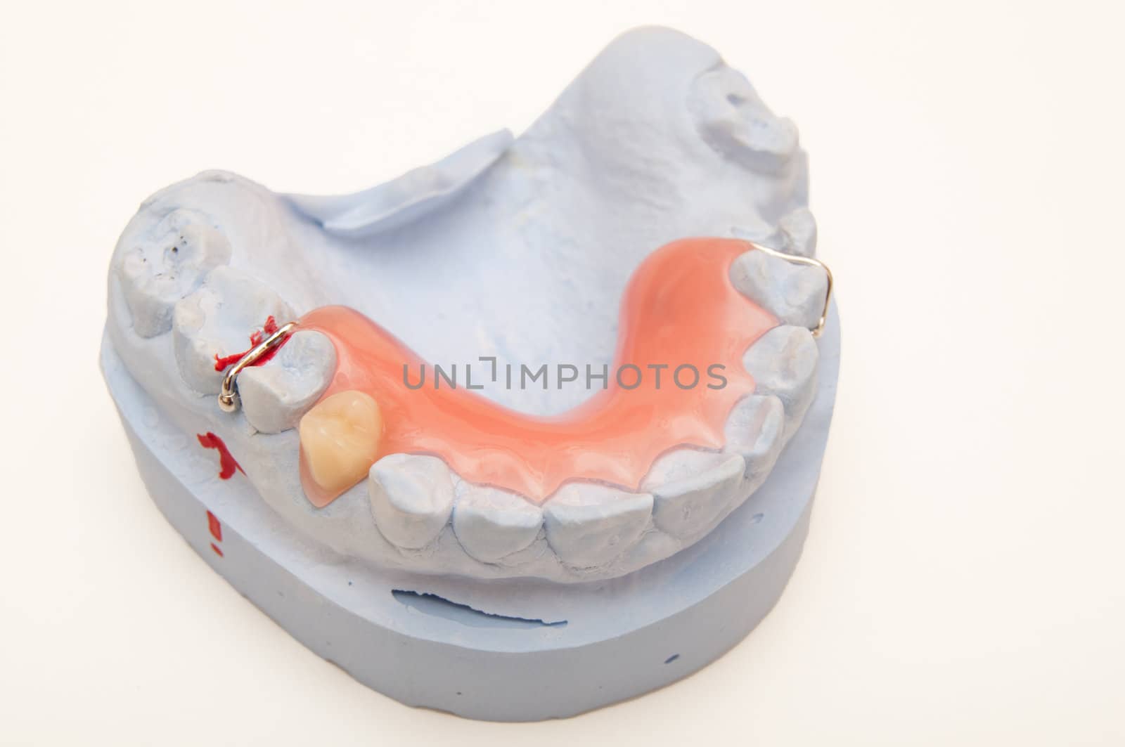 Mandible model by franz_hein