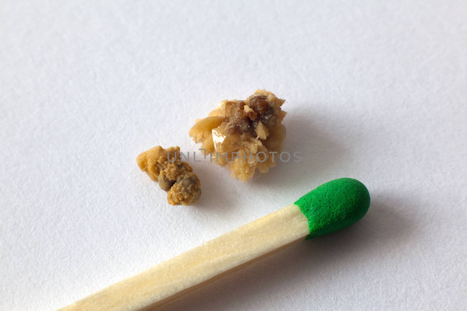 Kidney stones compared to match on macro shot
