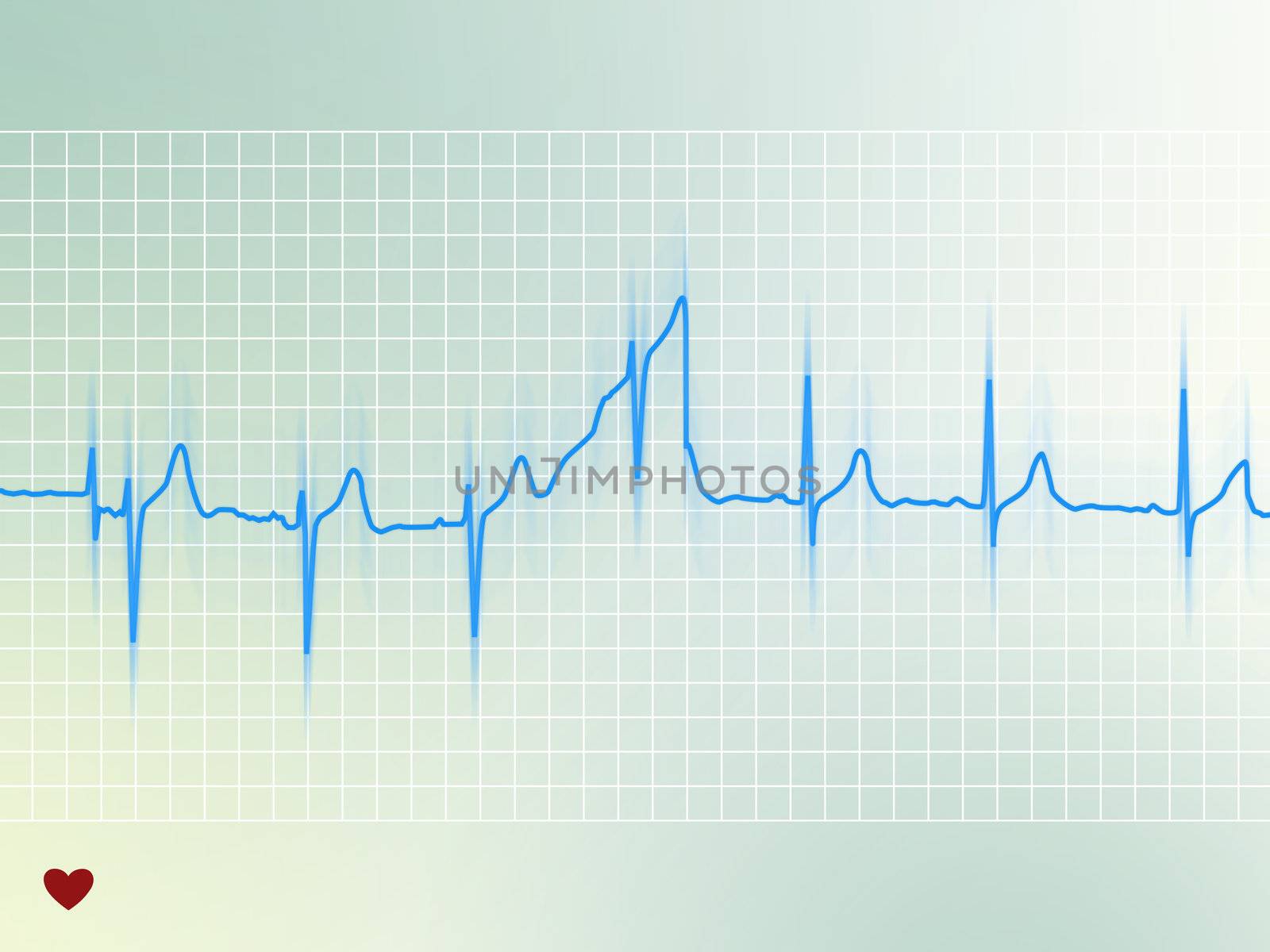 Electrocardiogram of a healthy heart (blue line on soft background)
