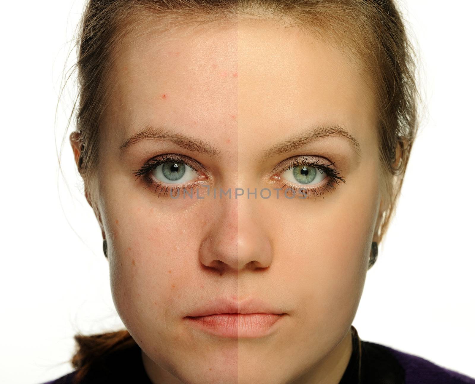 Retouch of a female portrait. Correction face women, an example usual and retouched