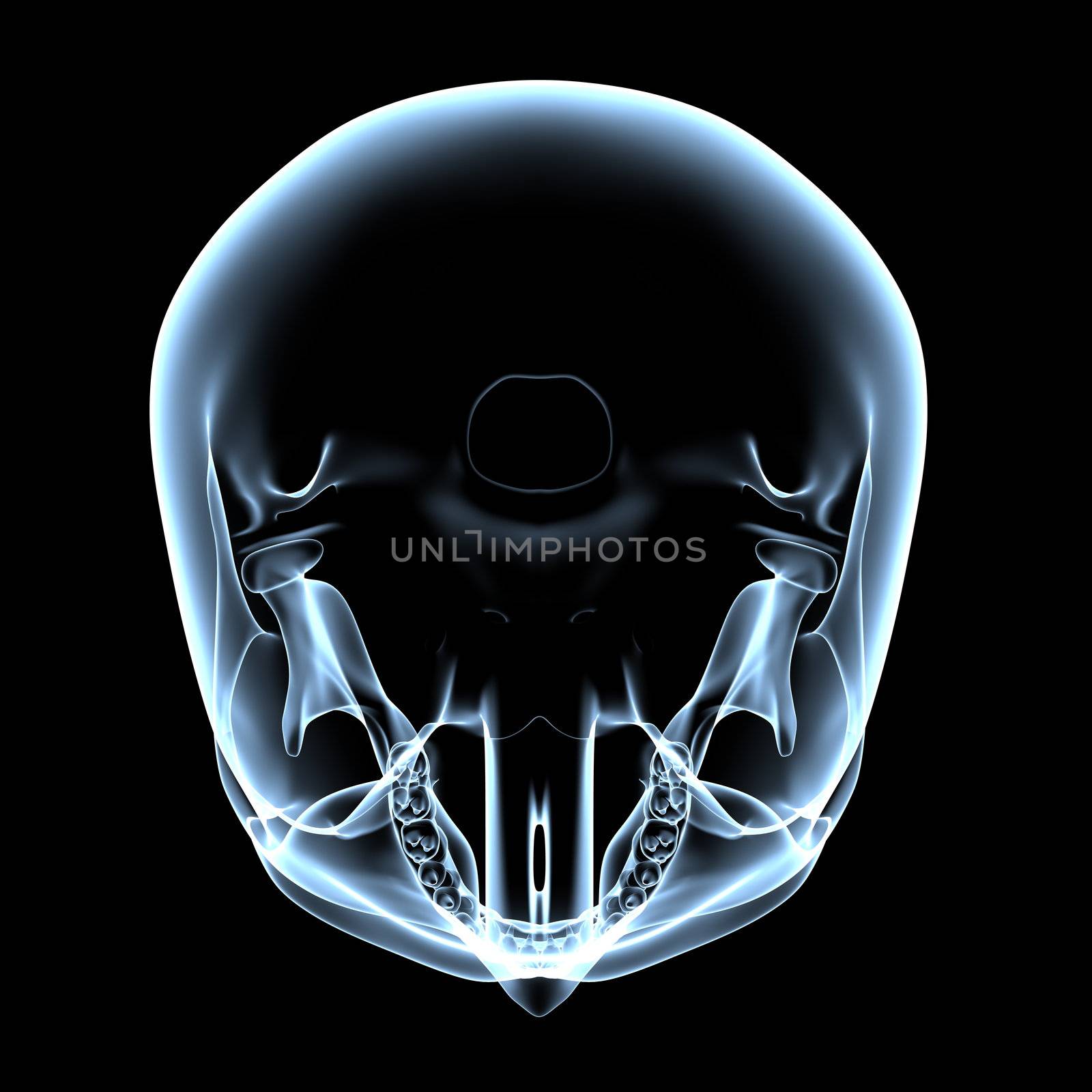 Human Skull - X-Ray Top View by PixBox