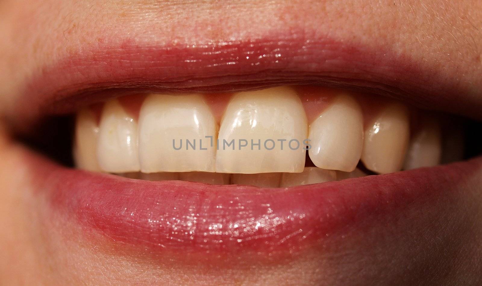 Close up of woman teeth