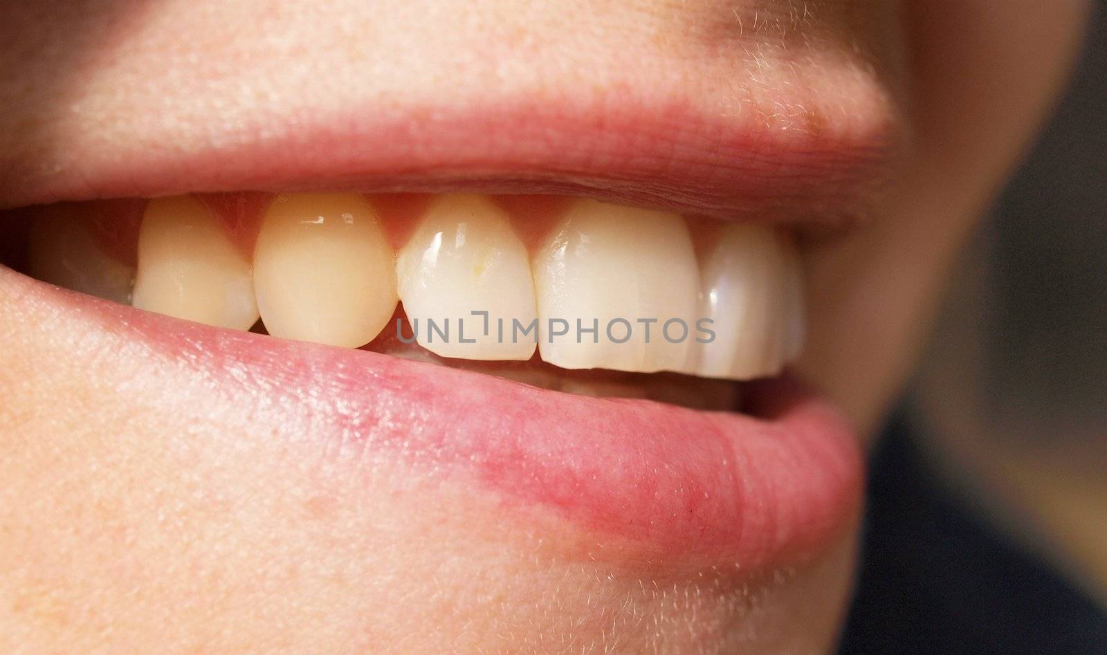 Close up of woman teeth