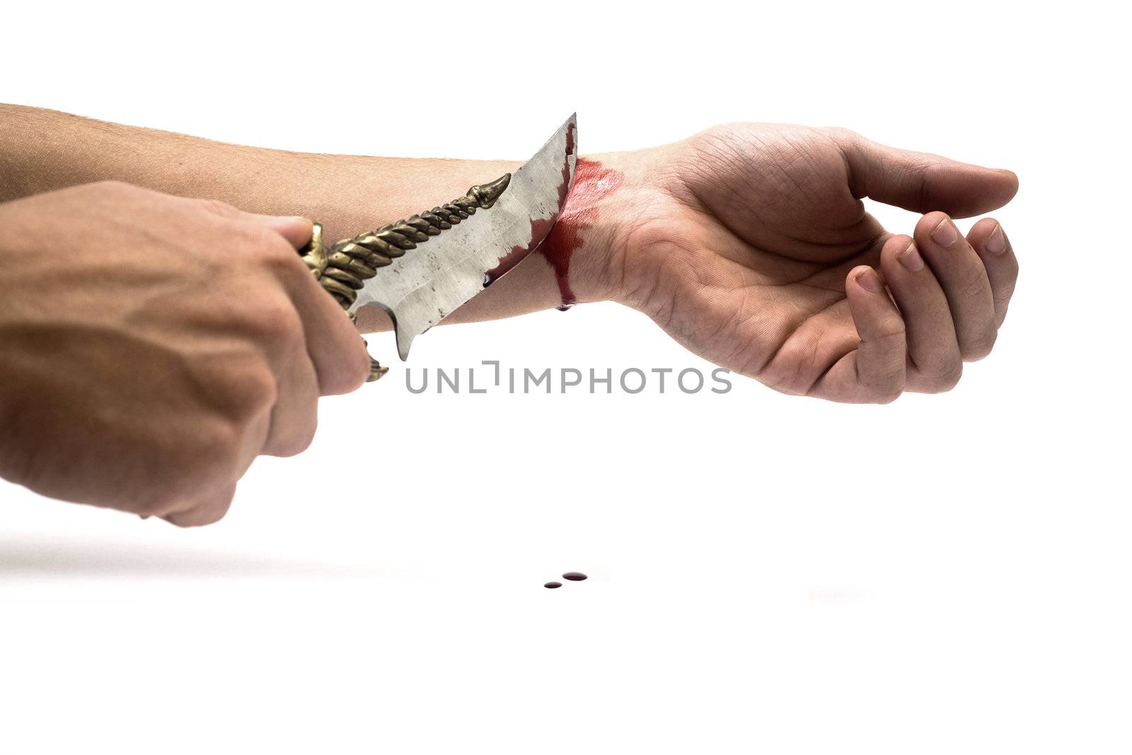 A bloody knife and a cut wrist, isolated on white. This image has innumerous uses like accidents, domestic violence, suicide, murder, hate, etc...
