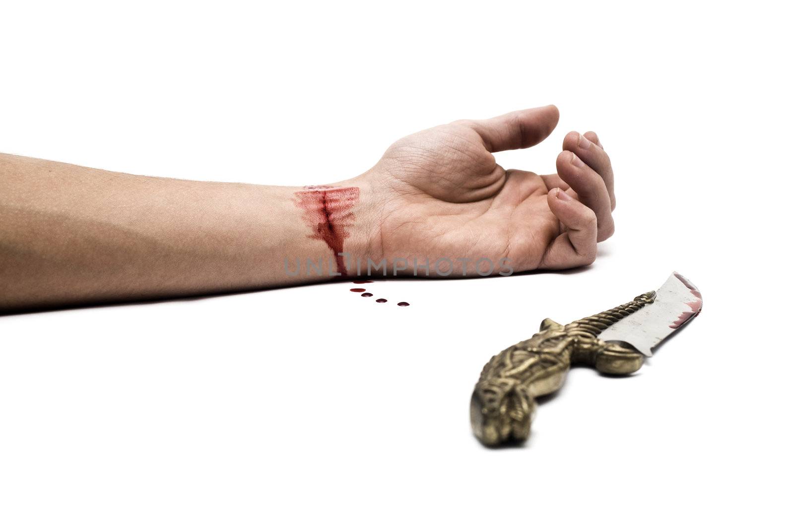 A bloody knife and a cut wrist, isolated on white. This image has innumerous uses like accidents, domestic violence, suicide, murder, hate, etc...
